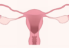 Gynecological Health